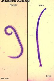 A.duodenale.jpg