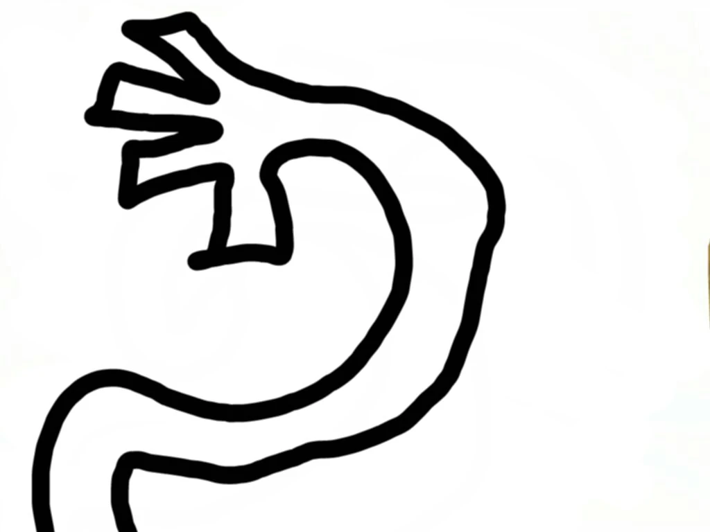 Long Arms Elastic Character Wiki FANDOM powered by Wikia