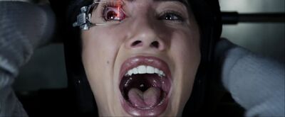 Eye surgery goes wrong