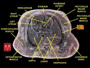 Thorax section 3