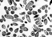 Coxiella burnetii 01