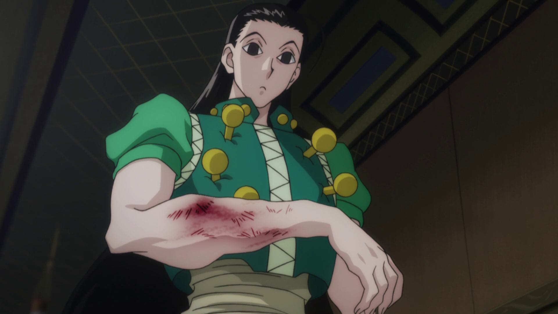 Image result for Hunter x Hunter illumi broken arm