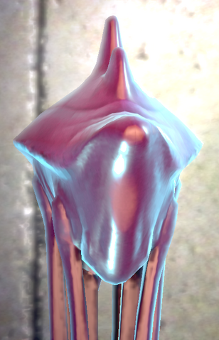 File:Opold1.png