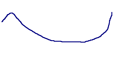 case diabetes in pets fandom powered by wikia levemir chart