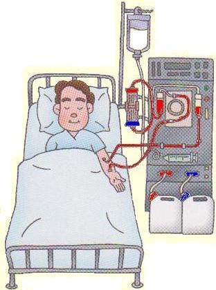 Dialysis Inducement | Superpower Wiki | Fandom powered by Wikia