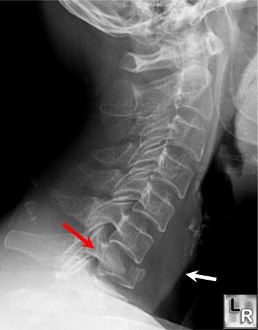 File:Neck.jpeg