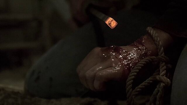 File:3x10 cauterize.jpg