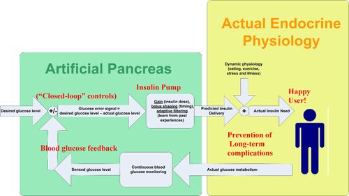 Artificial Pancreas