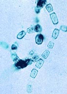 Coccidioides.jpg
