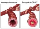 Bronquiolo com.jpg