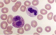 Eosinofilo.jpg
