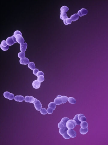 Arquivo:Streptococcus.jpg
