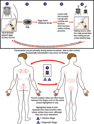 Arquivo:Scabies LifeCycle.gif