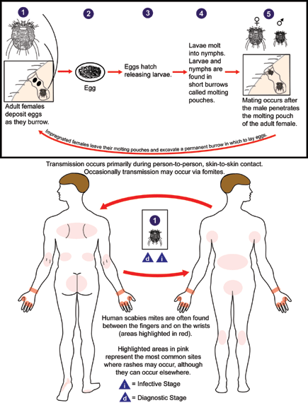 Scabies LifeCycle.gif