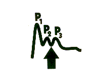 HIC 8.png