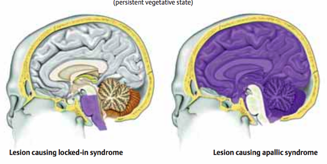 Arquivo:Neuro6.png