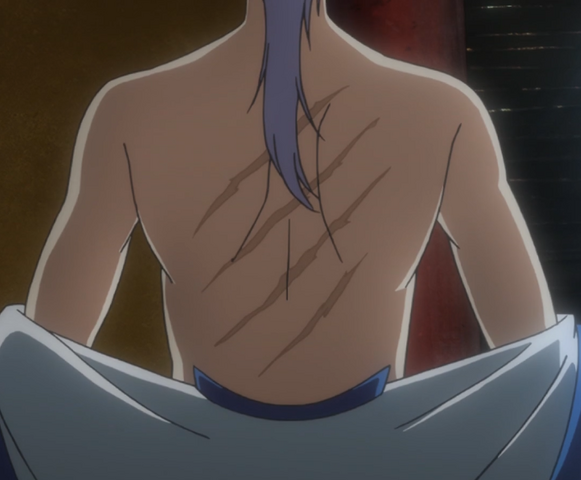 File:Kija's Scars.png