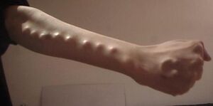 Armspine1.jpg