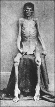Andersonville Survivor