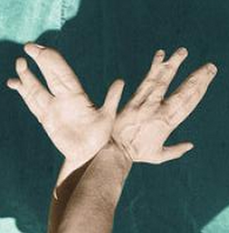 File:Lobsterhands2.png