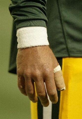 File:Broken Thumb.jpg