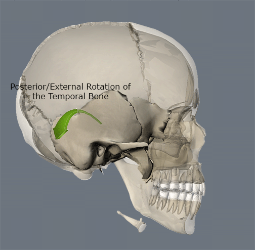 Sphenoid Temporal Coupling2 PAPDP