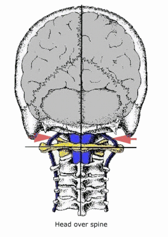 File:FHP Posterior View.gif