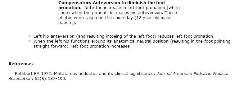 Compensatory Anteversion to decrease intoeing