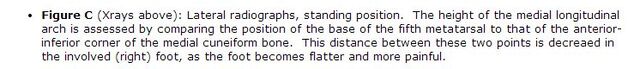File:PTTD Xray Description.jpg