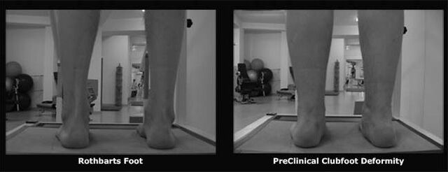 File:Knees Straight.jpg