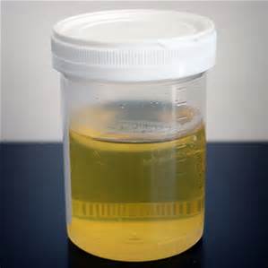 File:Urine.jpg
