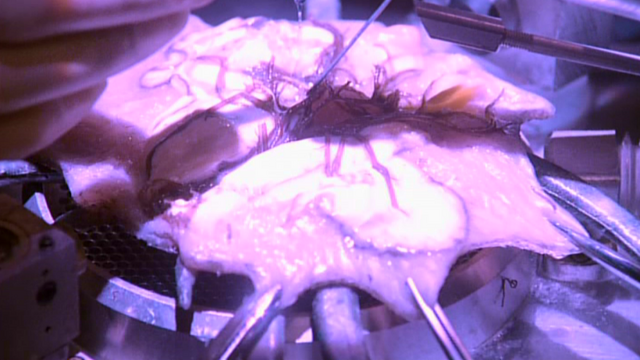 File:Keeper dissected.png