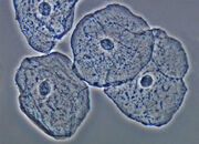 4º Células mucosa bucal.jpg