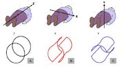 Mri-scannercoils