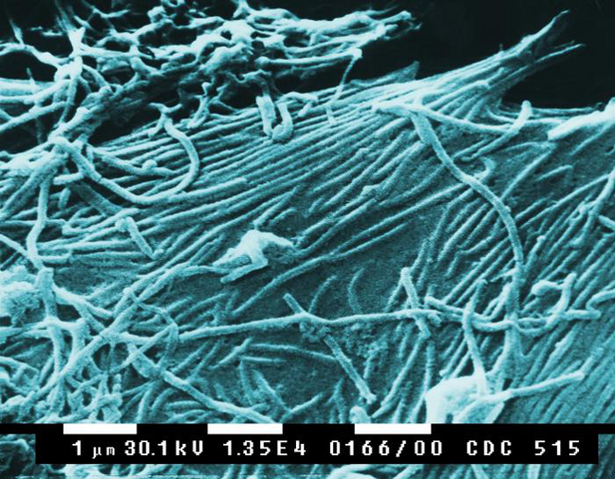 Arquivo:Ebola virions.png