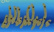 180px-Nematodes 1.jpg