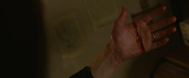 File:Margaret Cuts Herself.jpg