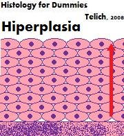 Hiperplasia-1-.jpg