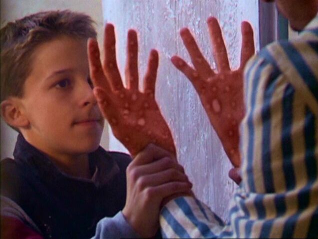 File:Ari incinerating his wrist.jpg