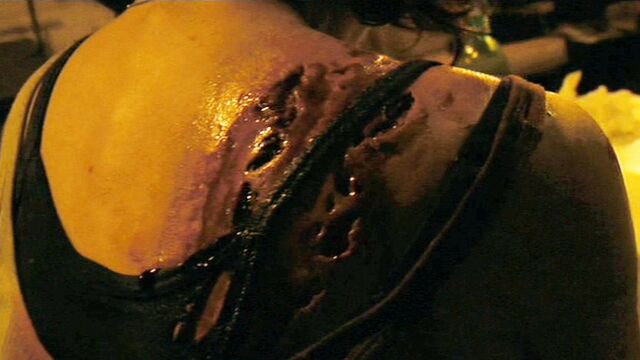 File:ParasiteBite.jpg
