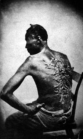 File:Slave scars.jpg
