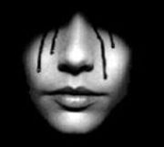 Bleeding-Eyes
