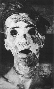 SCP-106 Victim