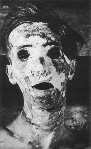 Datei:SCP-106 Victim.jpg