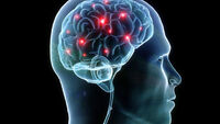 Brain-stock