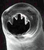 Hookworm big
