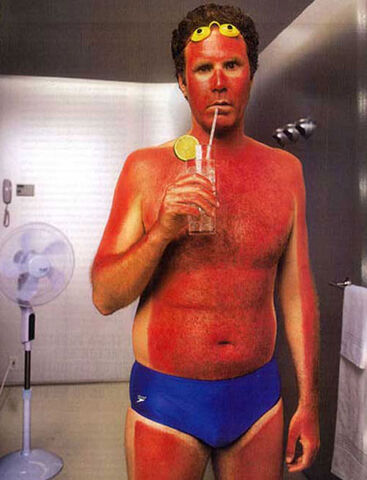 File:Sunburn time.jpg