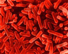 Bacteria-legionella
