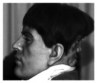 EdwardMordake.jpg