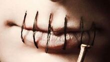 Lip sewing